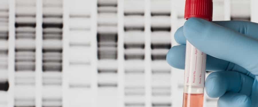 genomic testing for cancer genomic testing for cancer
