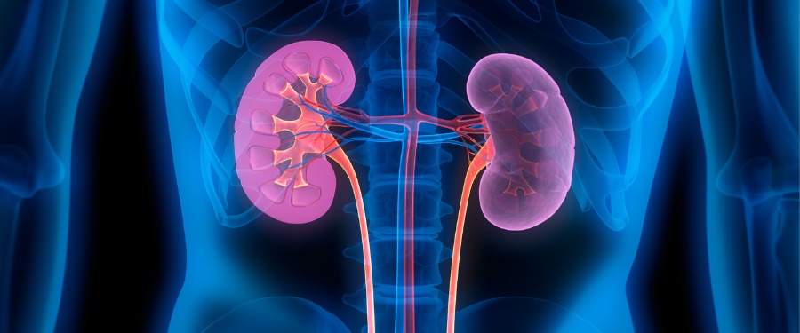 Illustration of the kidneys with IgAN Illustration of the kidneys with IgAN