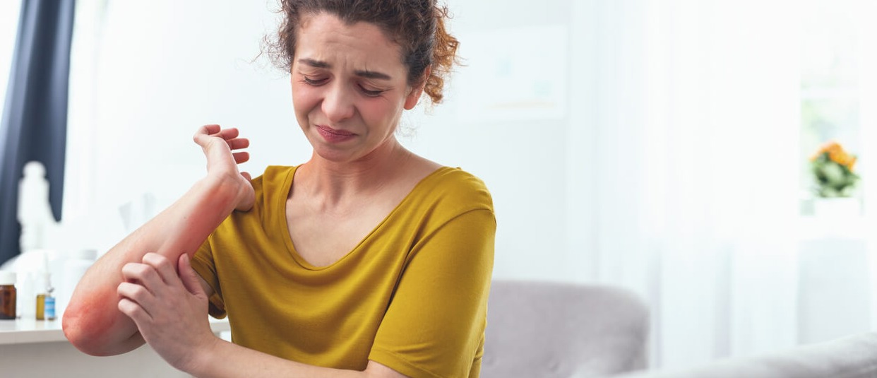 eczema-research eczema-research