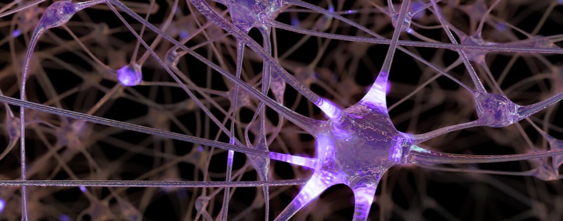 parkinsons-neuron-dyskinesia parkinsons-neuron-dyskinesia