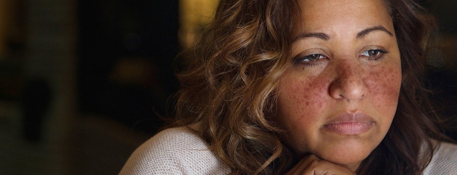 woman-with-lupus-419013-edited.jpg woman-with-lupus-419013-edited.jpg