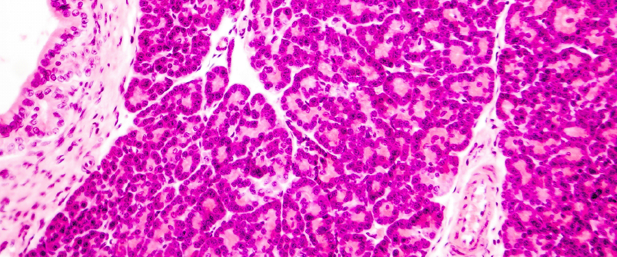 #CureChat17 Round-up