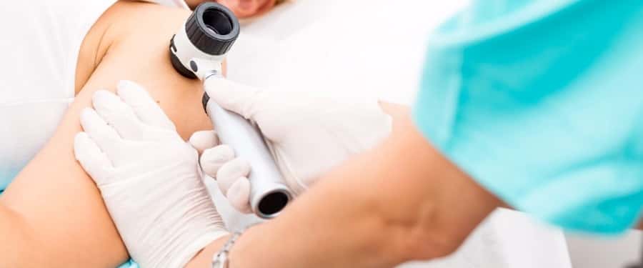 Doctor checking patient for melanoma symptoms